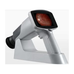 Hand-held Fundus Camera MediWorks FC161
